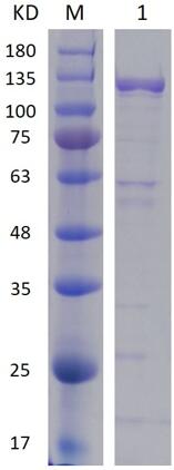 12% SDS-PAGE analysis profiles of purified PA1527-133-1162 (CBB stained).